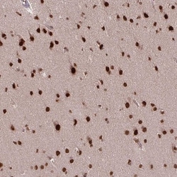 SS18 Antibody, Novus Biologicals:Antibodies:Primary Antibodies